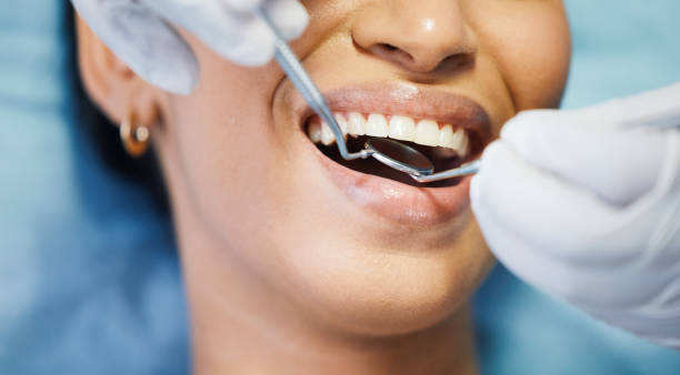 Best Chipped Tooth Repair Near Me  in Orange City, FL