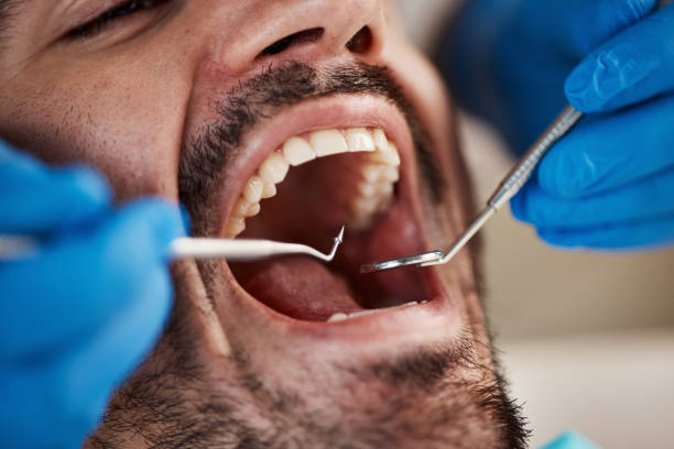 Best Dentist for Tooth Abscess  in Orange City, FL